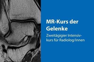 Strukturen eines Kniegelenks
